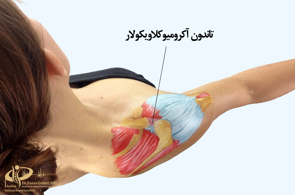 تاندون آکرومیوکلاویکولار