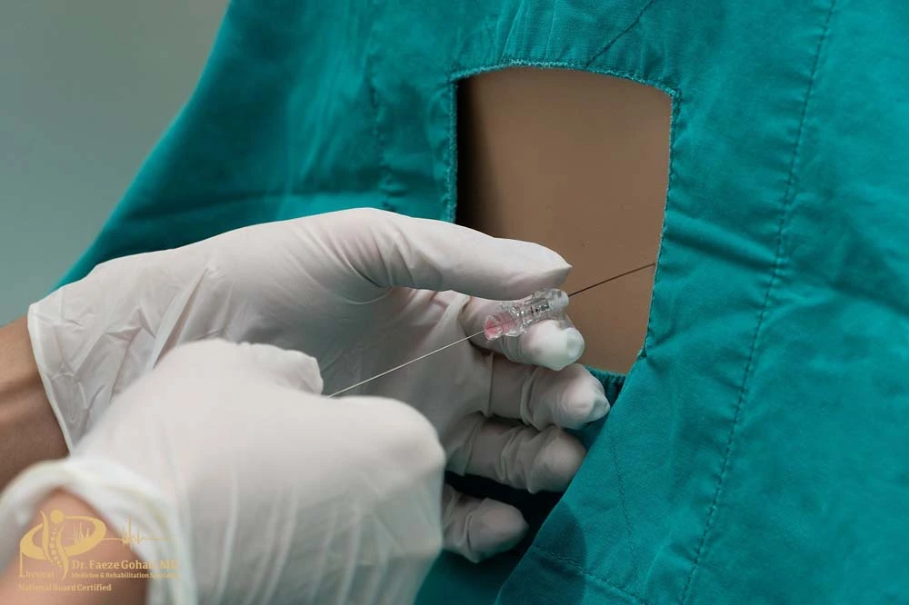 هدایت کاتتر