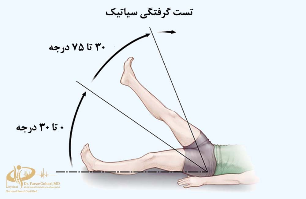 تست گرفتگی سیاتیک