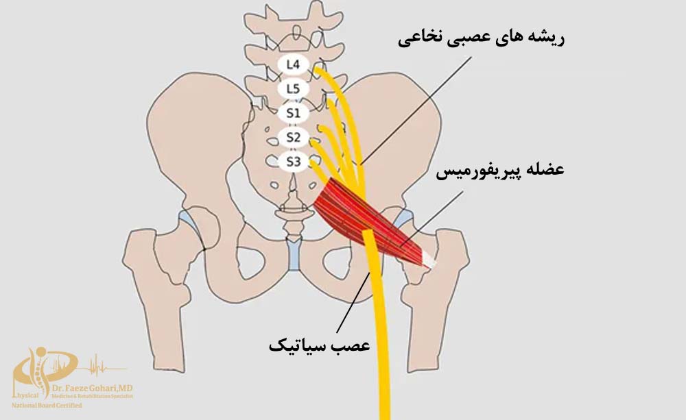 ریشه های عصبی نخاعی