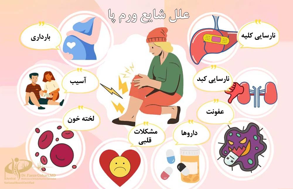 ورم مچ یا ساق پا