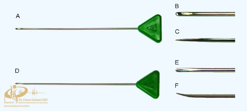 تزریق اپیدورال ترانس‌فورامینال