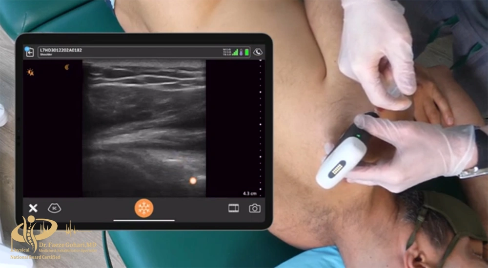 تزریق تحت هدایت سونوگرافی