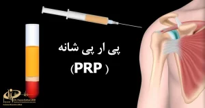 پی آر پی شانه