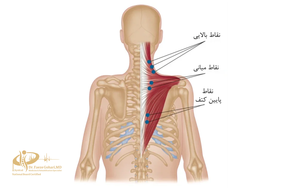 دردهای عضلانی