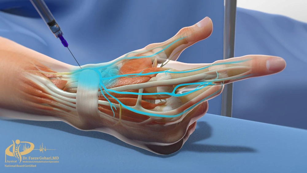 بلوک عصبی دست