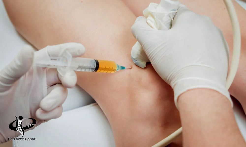 آرتروز زانو