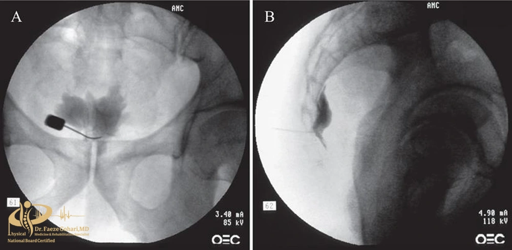 تصویربرداری زنده