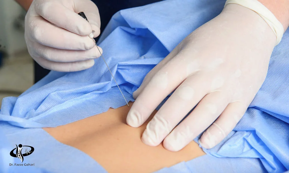 التهاب مفاصل فاست کمر یا گردن