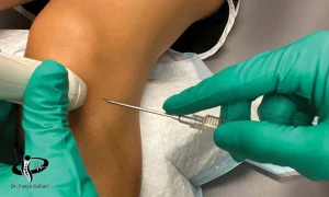 ارتوکین تراپی