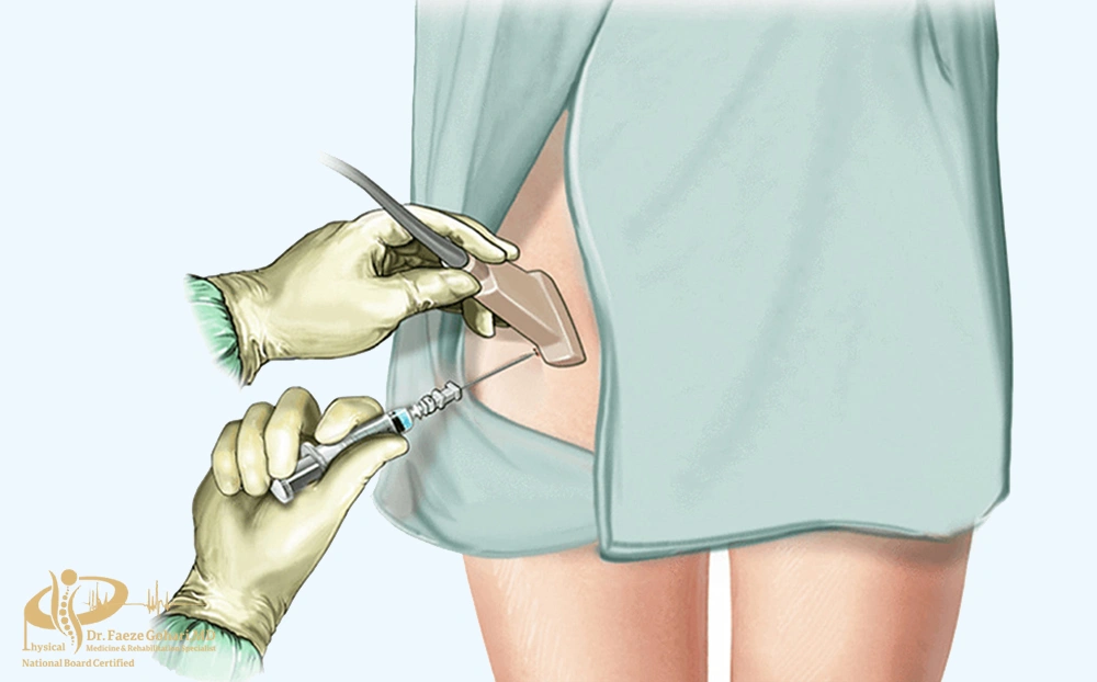 بلوک عصبی سیاتیک