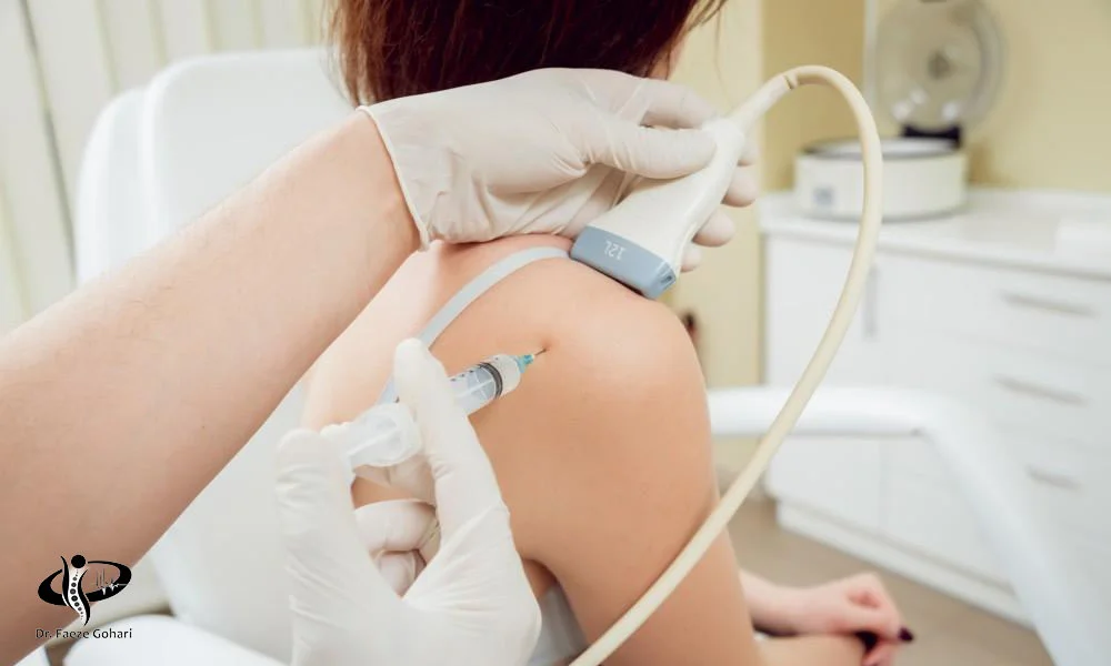 آرتروز شانه