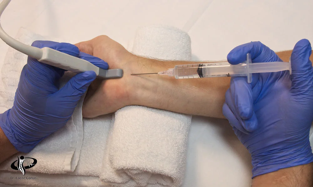 آرتروز مچ دست یا پا